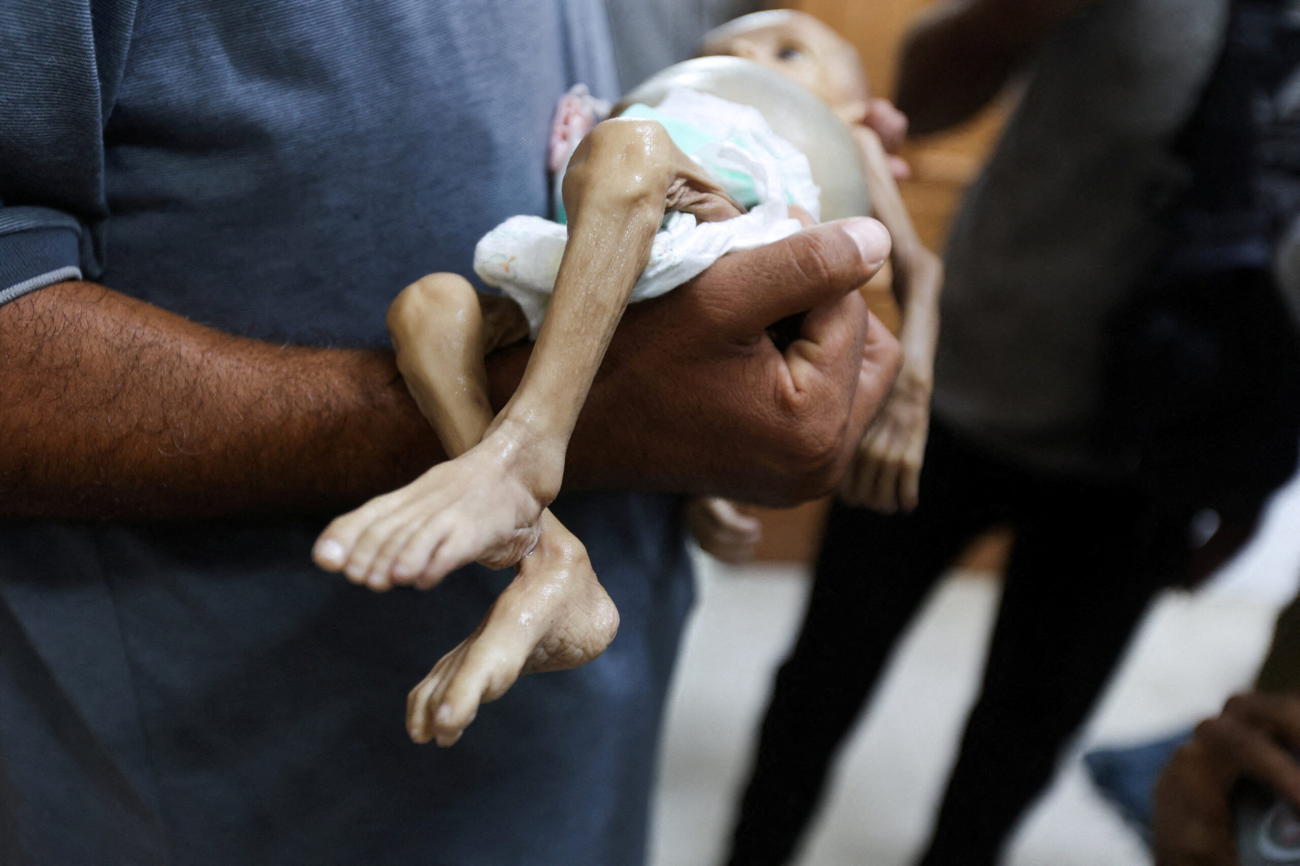 Eleven more people die in Gaza, said Hamas health ministry