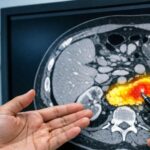 New AI Tool Spots Pancreatic Cancer Before Doctors Can